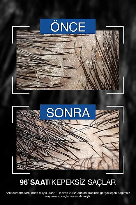 For Men Erkek Mentol ve elma Sirkesi Ve Kompleks B19 Saç Şampuan 360 Ml - 6