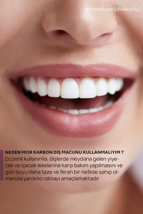 The Ceel Diş Beyazlatıcı Aktif Mor Karbon Diş Macunu 75 gr - 7